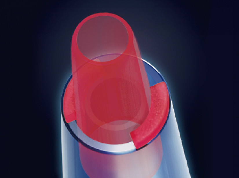 POWERRING PRO nanometric image
